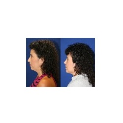 Image for Gregory Keller Plastic Surgery with ID of: 4289578