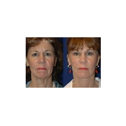 Image for Gregory Keller Plastic Surgery with ID of: 4289579
