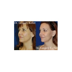 Image for Gregory Keller Plastic Surgery with ID of: 4289581