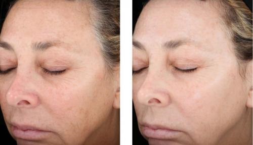 Image for Broadway Skin Essentials with ID of: 4314138