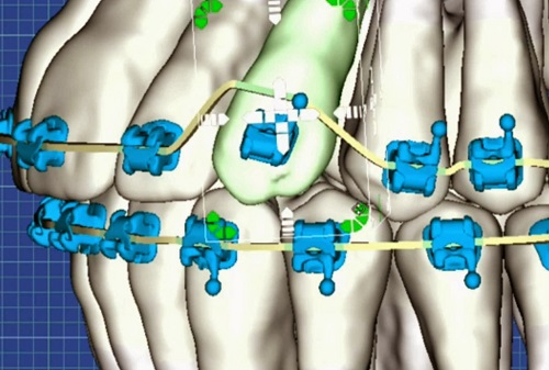 Image for Reese Orthodontics with ID of: 4318950