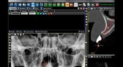 Image for 3D Viewing Software Market | World Players Forecast Analysis Till 2025 with ID of: 4339823