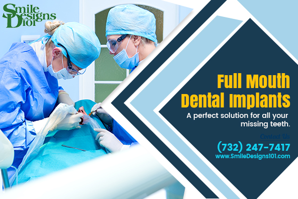 Image for Full Arch Teeth Replacement with Dental Implants with ID of: 4340462