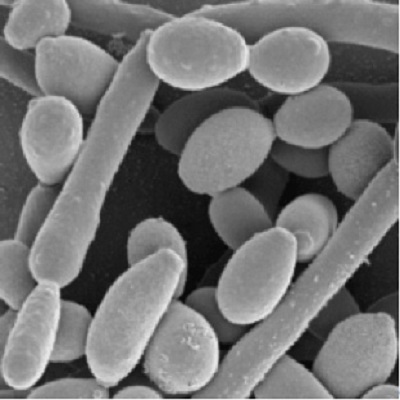 Image for Candida Albicans Antigens with ID of: 4352542