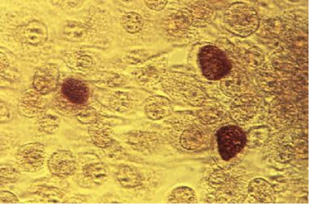 Image for Chlamydia Trachomatis Antigens with ID of: 4352573