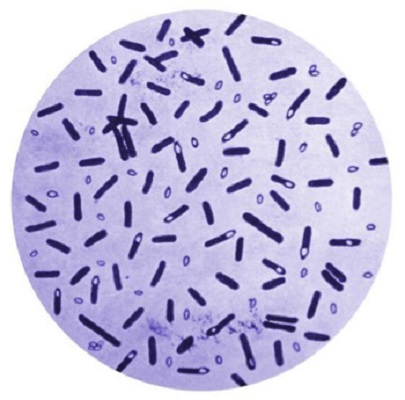 Image for Clostridium Antigens with ID of: 4352585