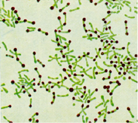 Image for Corynebacterium Diphtheriae Antigens with ID of: 4352596