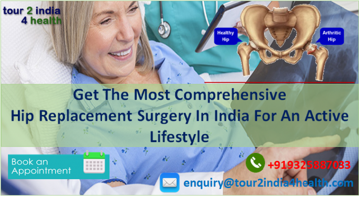 Image for Hip replacement surgery in India with ID of: 4384555