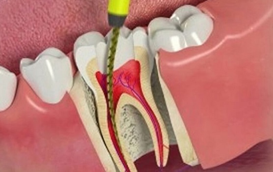 Image for Dr. Jerry Yang, DDS with ID of: 4389571