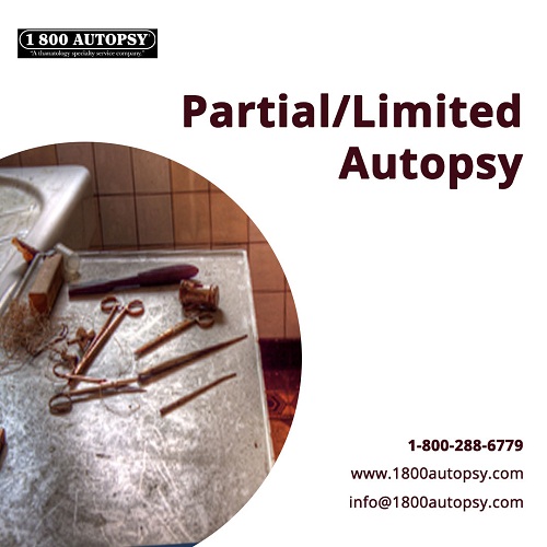 Image for Partial/Limited Autopsy with ID of: 4390003