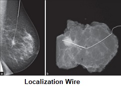 Image for Localization Wire Market | World Players Forecast Analysis Till 2025 with ID of: 4390152