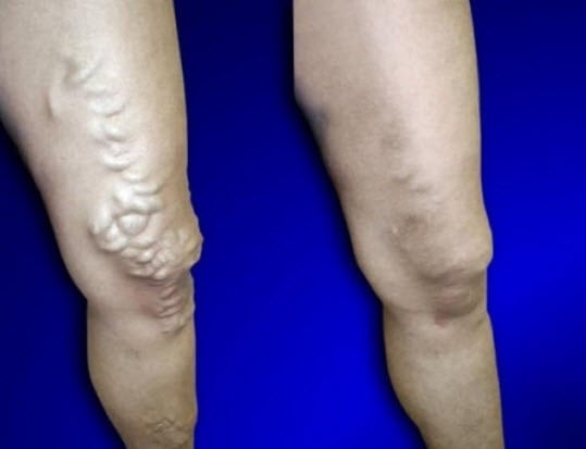 Image for USA Vein Clinics with ID of: 4391578