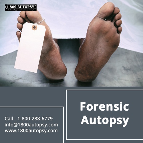 Image for Forensic Autopsy with ID of: 4401306