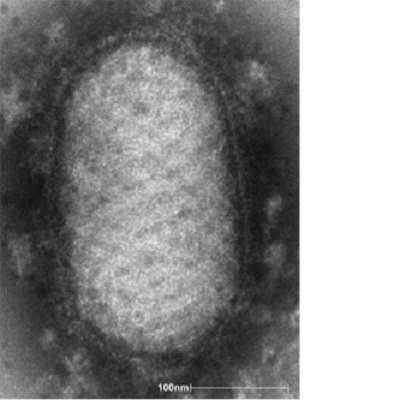 Image for Orf Virus Antigens with ID of: 4404342
