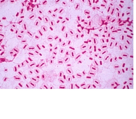 Image for Haemophilus influenza Antigens with ID of: 4404361