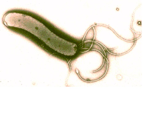 Image for Helicobacter pylori Antigens with ID of: 4404363