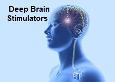 Image for Deep Brain Stimulators Market | World Players Forecast Analysis Till 2025 with ID of: 4416910