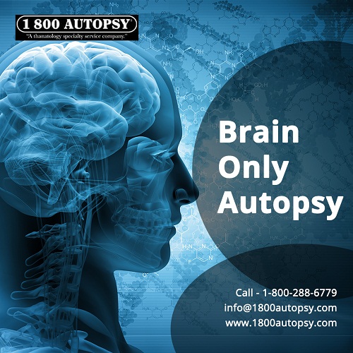 Image for Brain Only Autopsy with ID of: 4424172