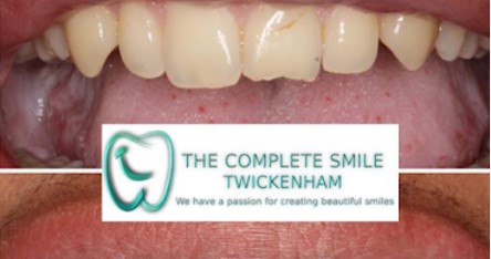 Image for The Complete Smile Twickenham with ID of: 4425890