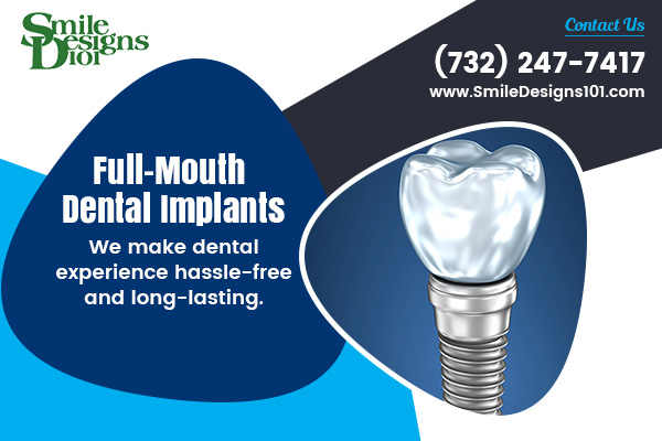 Image for What Should You Know About Dental Implants? with ID of: 4427181