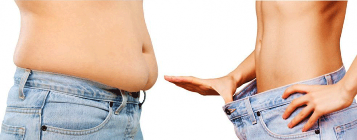 Image for Weight Loss treatments in Islamabad with ID of: 4432378