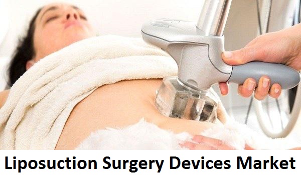 Image for Liposuction Surgery Devices Market Size Worth $1.2 Billion By 2026 with ID of: 4446266