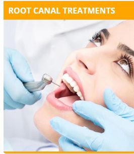 Image for root canal specialist in thiruvalla with ID of: 4450133