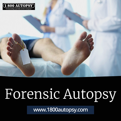 Image for Forensic Autopsy with ID of: 4453688