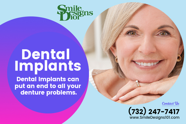 Image for Boost Your Smile with Dental Implants with ID of: 4475272