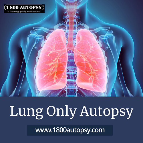 Image for Lung Only Autopsy with ID of: 4477099