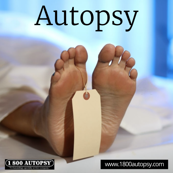 Image for Autopsy with ID of: 4488065