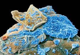 Image for poliovirus type 1 antibody with ID of: 4498260