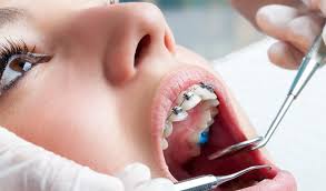 Image for UFT Orthodontist Brooklyn with ID of: 4501025