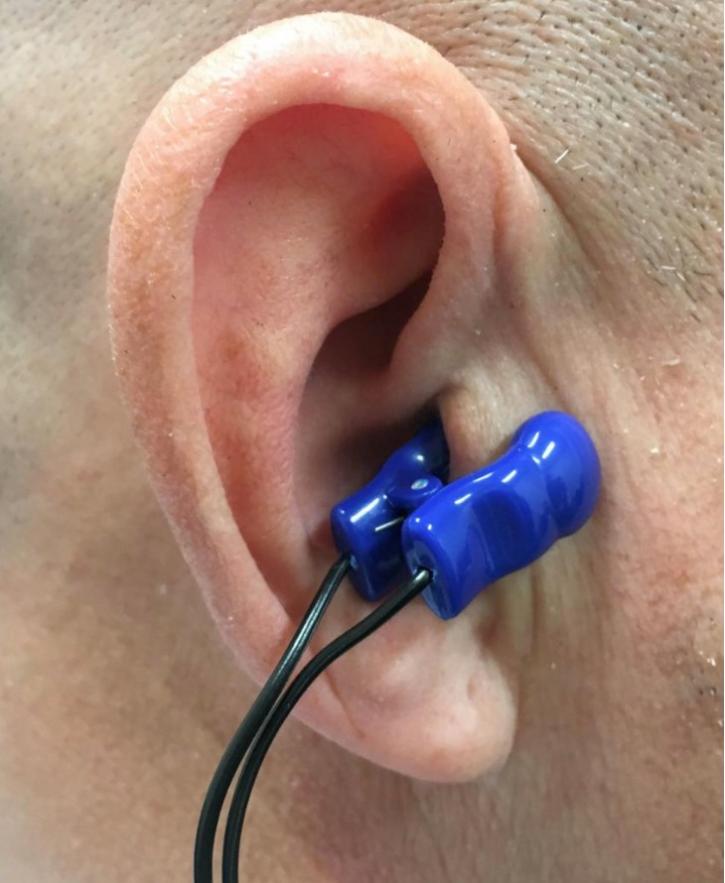 Image for Nerve Interventional Device Market Status & Supply Demand | Industry Forecast Report To, 2025 with ID of: 4521450