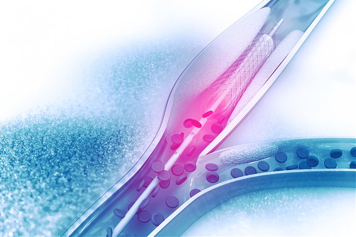 Image for Peripheral Vascular Devices Market: COVID-19 Impact on the Peripheral Vascular with ID of: 4564706