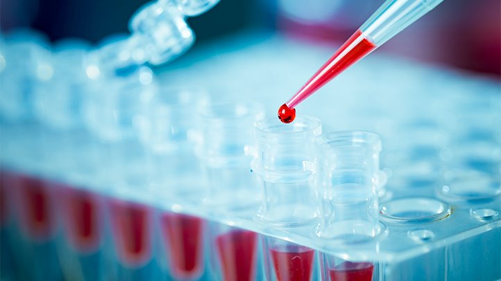 Image for VLP-based Vaccine Development for SARS-CoV-2 with ID of: 4587709