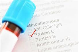 Image for Activated Partial Thromboplastin Test Market Status & Supply Demand | Industry Forecast Report To, 2025 with ID of: 4648149
