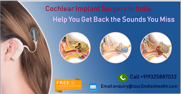 Image for Cochlear Implant surgery Cost  in India with ID of: 4678222