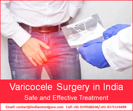 Image for Varicocele Surgery India with ID of: 4696411