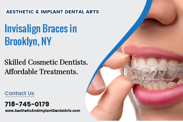Image for Invisalign braces Brooklyn NY with ID of: 4701958