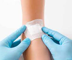 Image for Global Advanced Wound Care Market Share is Expected To Get Massive Growth Profits by 2026 with ID of: 4820968