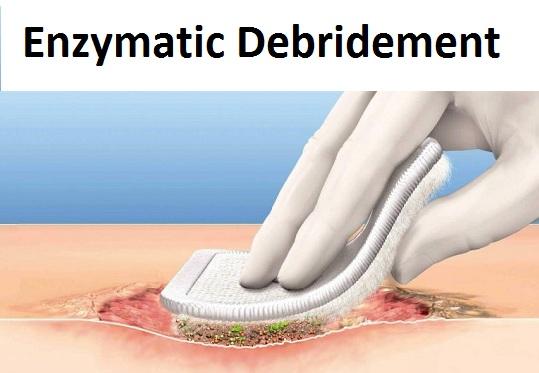 Image for Global Enzymatic Debridement Market Share is Expected To Get Massive Growth Profits by 2026 with ID of: 4829435