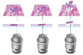 Image for Laser Capture Microdissection Market Size, Demand, Growth And Industry Development Trends By 2021-2026 with ID of: 4853040