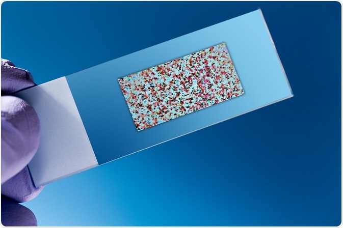Image for Global DNA Microarray Market Share is Expected To Get Massive Growth Profits by 2026 with ID of: 4853044