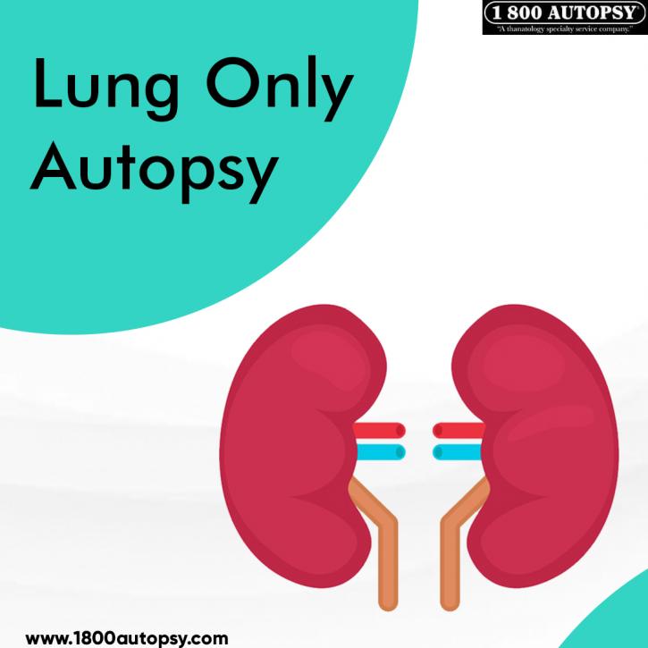 Image for Lung Only Autopsy with ID of: 4918600