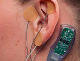 Image for Global Neurostimulation Devices Market Share is Expected To Get Massive Growth Profits by 2026 with ID of: 4962898