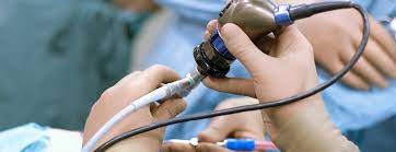 Image for Endoscopic Market Emerging Trends And Growth Analysis Report 2021-2027 with ID of: 4970982