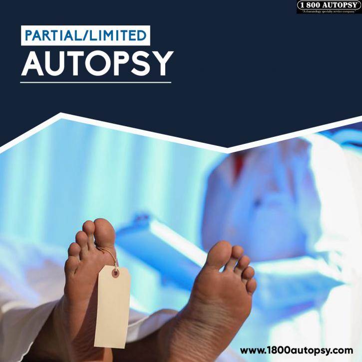 Image for PARTIAL/LIMITED AUTOPSY with ID of: 4972988