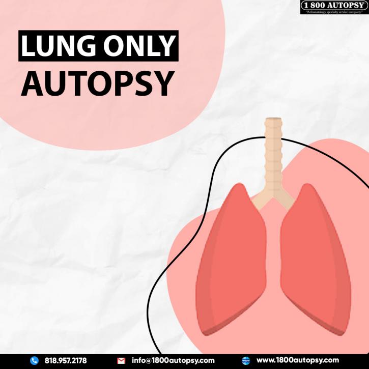 Image for Lung Only Autopsy with ID of: 5003990