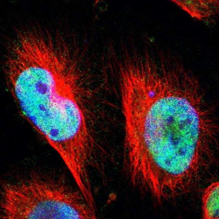 Image for Clock Antibody Market Share is Expected To Get Massive Growth Profits by 2026 with ID of: 5015944